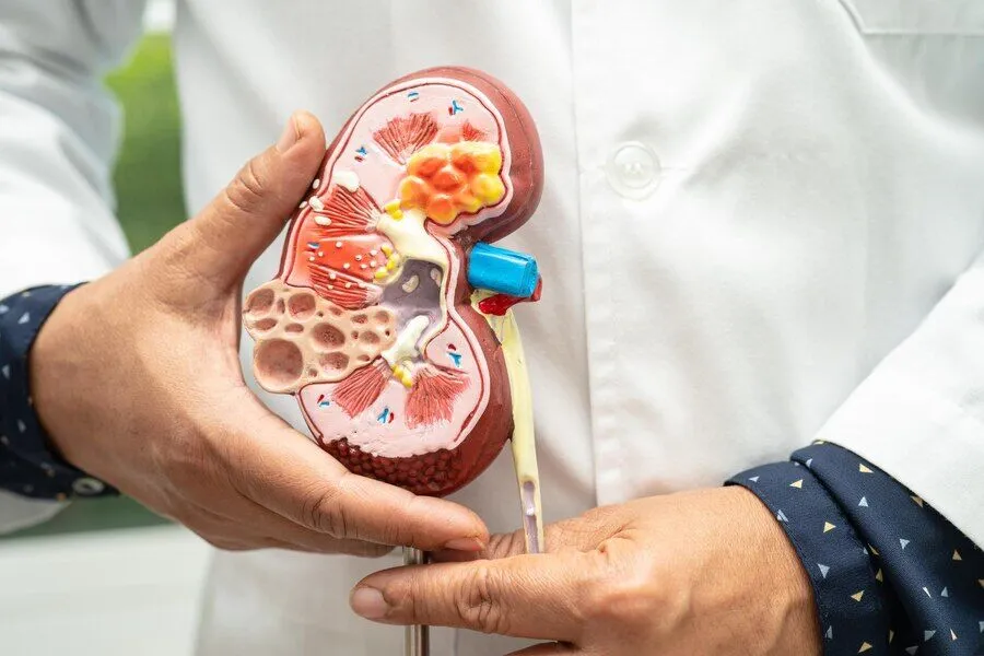 böbrek taşı tedavisi